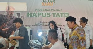 BAZNAS Jabar Kembali Hadirkan Layanan Hapus Tato Gratis, Kali Ini Gandeng Ponpes Attamur